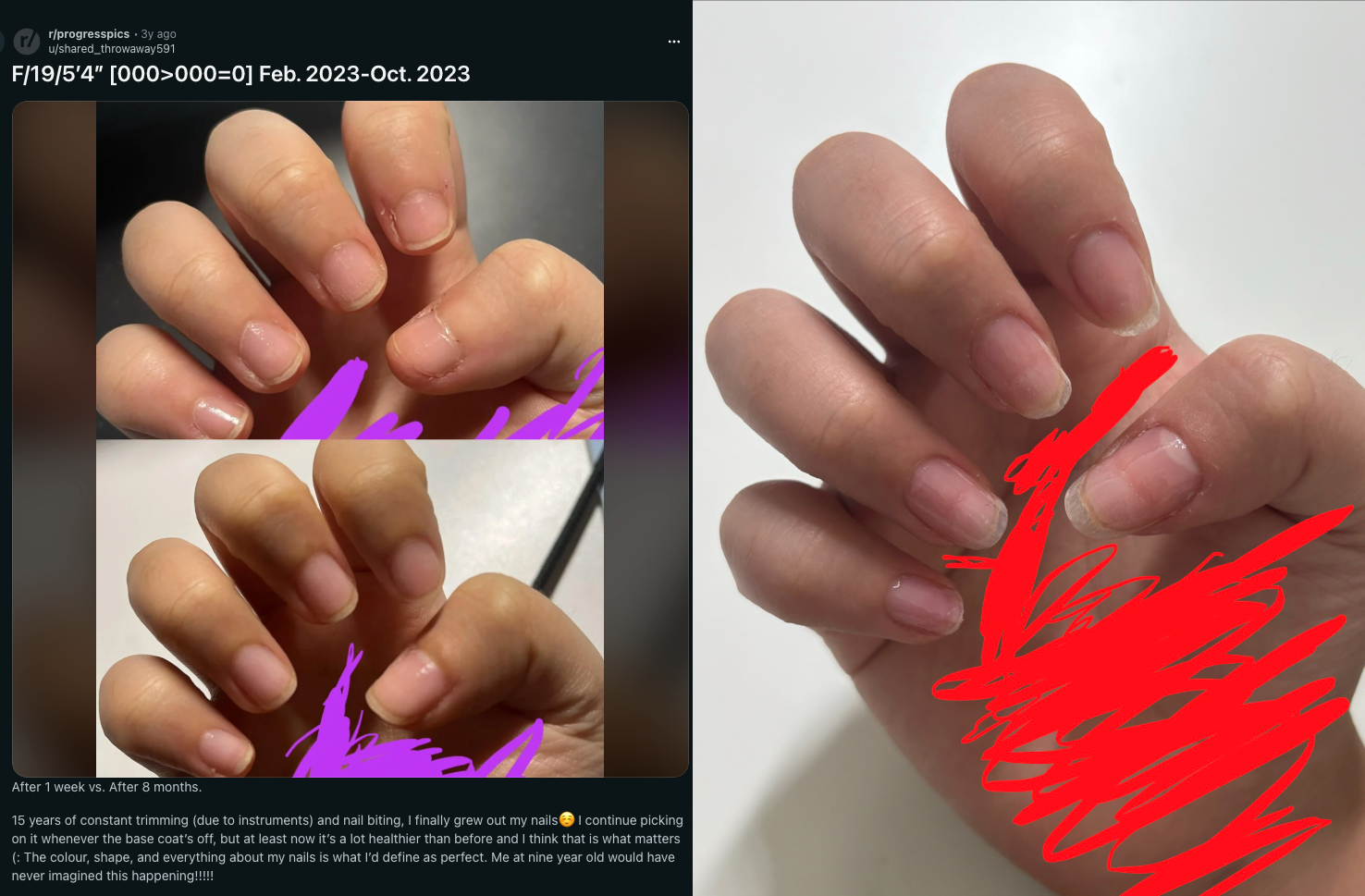 Guía completa para el cuidado y fortalecimiento de tus uñas 💅