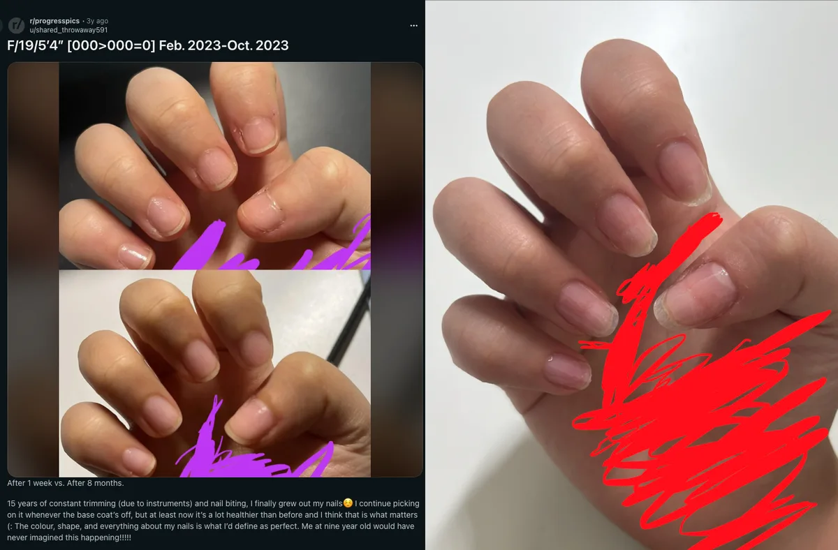 Guía completa para el cuidado y fortalecimiento de tus uñas 💅